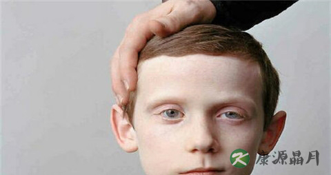 针灸治疗面瘫的方法 针灸治疗面瘫的方法