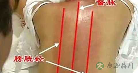膀胱经酸痛是什么原因