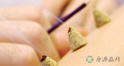 艾灸什么穴位祛痘