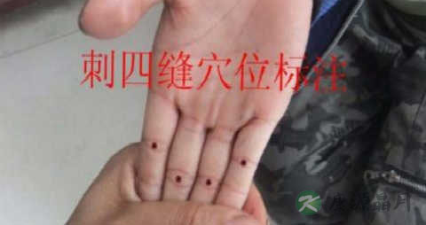肚子涨按什么穴