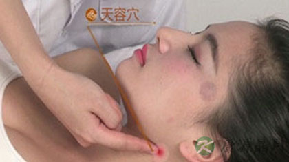按摩天容穴缓解咽炎 天容穴怎样找
