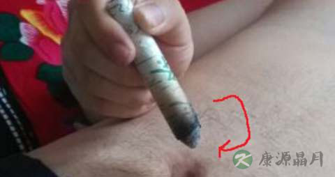 艾灸肚脐不出水怎么回事