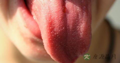 风热感冒的食疗方法