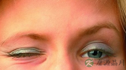 眼皮跳是什么原因造成的呢