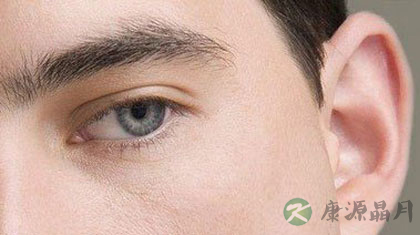 耳鸣患者吃什么比较好