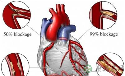 食用蛋白质可有效预防心血管疾病 食用蛋白质可有效预防心血管疾病