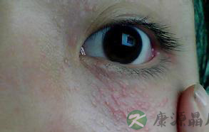 4个部位长脂肪伤身 肝脏引发糖尿病 4个部位长脂肪伤身 肝脏引发糖尿病