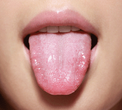 舌诊！从舌头中看出疾病