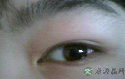 提醒！慢性肾炎的三大早期症状