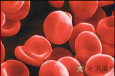 贫血患者注意饮食习惯可有效改善身体