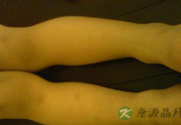 从走路姿势看寿命长短 8种步态的隐患