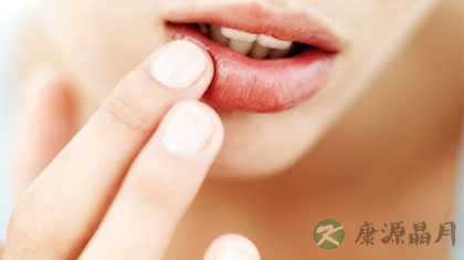 冬季嘴唇干裂的原因及护理方法