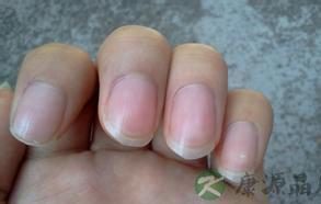 如何通过指甲看身体健康状况? 如何通过指甲看身体健康状况?