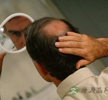 男性养生常识 为何男性在夏季容易脱发? 男性养生常识 为何男性在夏季容易脱发?