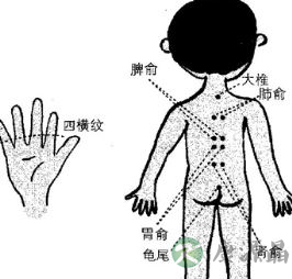小儿腹泻、厌食该怎么办 选择小儿推拿穴位养生