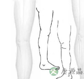 治疗风湿的方法 采取穴道按摩或穴道指压法