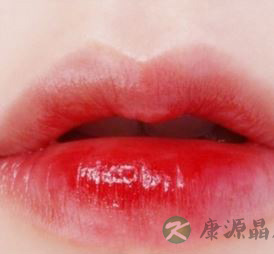 嘴唇糜烂，起水泡怎么办 如何防治唇炎呢？