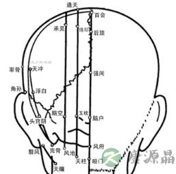 焦式头针疗法 各刺激区的定位及主治疾病