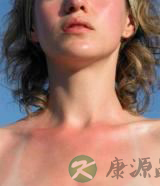 夏天晒黑了怎么办