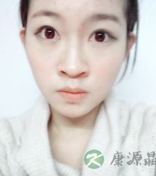 肝脏好不好 看看这些地方