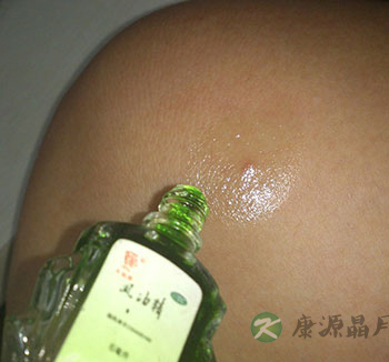 盘点风油精哪些不为人知的妙用 盘点风油精哪些不为人知的妙用