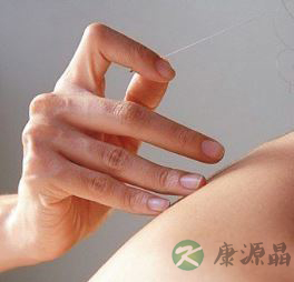 眼针疗法中的点刺法 点刺疗法的手法是如何