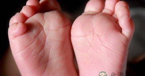 婴儿着凉拉稀怎么办