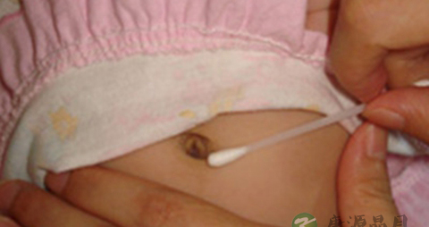 如何护理新生儿脐带_新生儿脐带护理方法