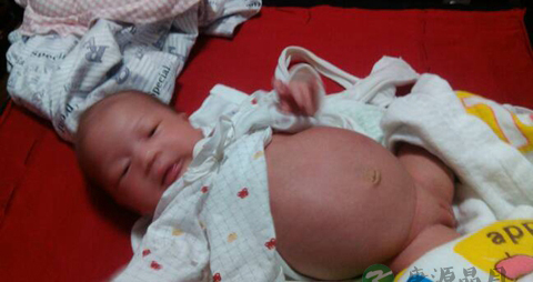 新生儿肚子胀如何应对_新生儿肚子胀应对方法