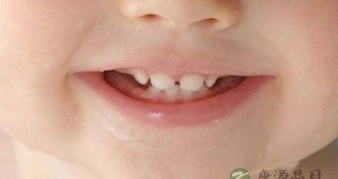婴儿长牙前的症状