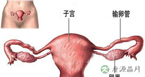取环后怀不上怎么回事