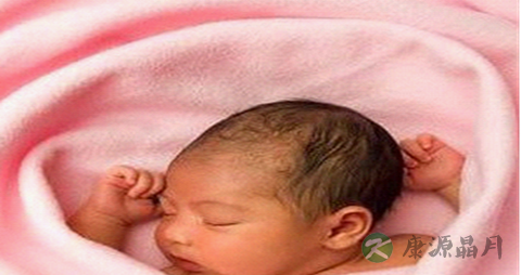 得了荨麻疹怎么办_荨麻疹的缓解治疗方法