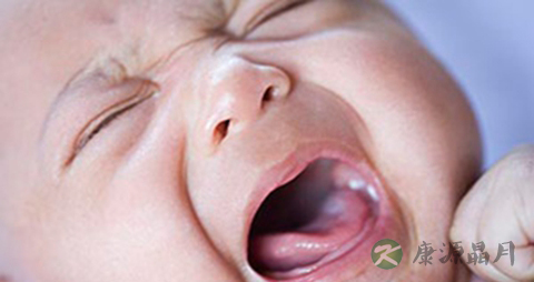 夏季宝宝上火怎么办_宝宝上火的缓解方法