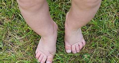 如何预防宝宝八字脚_预防宝宝八字脚方法 如何预防宝宝八字脚_预防宝宝八字脚方法