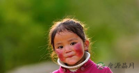 宝宝持续脸红是何原因_宝宝持续脸红的原因