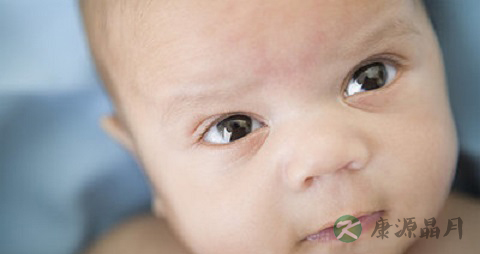 宝宝对眼需要看医生吗_宝宝对眼正常吗