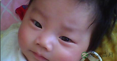 宝宝湿疹怎么办_宝宝湿疹治疗方法 宝宝湿疹怎么办_宝宝湿疹治疗方法