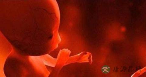 怀孕初期死胎的症状