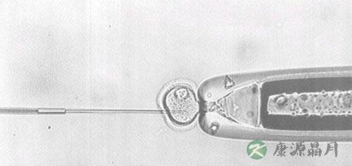 男性不育症有望被彻底治愈 后天预防仍是关键