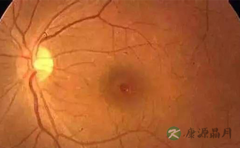 忘关闪光灯宝宝眼睛被灼瞎 远离5大“隐形杀手”