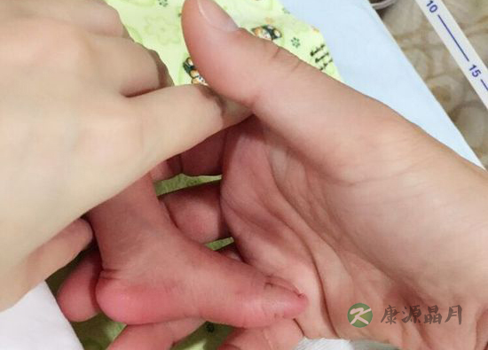 徐若瑄13日剖腹产Dalton 子宫虚的孕妇如何保胎