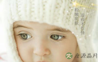 宝宝冬天也湿疹 妈妈三招击退