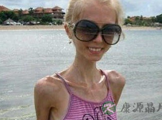 李咏13岁女儿婴儿肥甜美 青春期过度减肥要不得