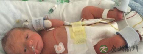 孕妇阵痛36小时 剖腹不见宝宝
