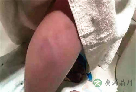 孩子考试没到80分遭老师毒打 拍照留证据可维权