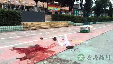 广州小学生被校车压死 早餐散落地上沾满血迹