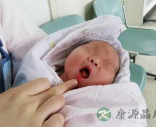 新生儿竟有一颗牙 或因妈妈孕期补钙超量所致