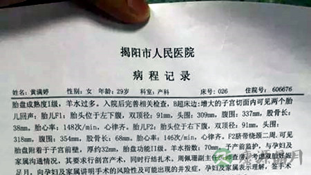 孕妇B超检查是双胞胎可生下来却是单 怎么回事？