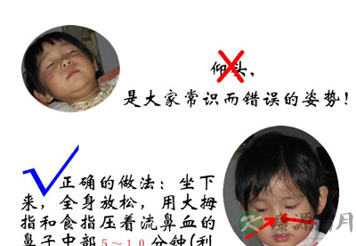 秋燥宝宝易流鼻血 鼻子塞纸巾不能止血