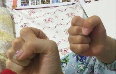 甜馨发高烧超42度 退热贴对孩子退烧没用